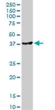ADH4 monoclonal antibody (M03A), clone 1D2