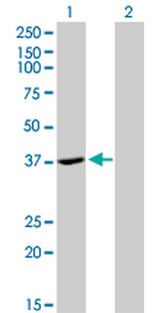 ADH4 monoclonal antibody (M01), clone 3C5