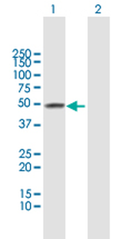 ADH4 MaxPab rabbit polyclonal antibody (D01)