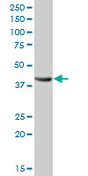 ADH4 purified MaxPab mouse polyclonal antibody (B01P)
