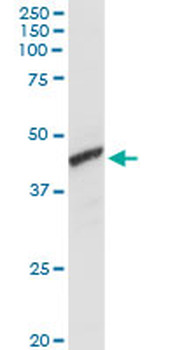 ADH1C MaxPab rabbit polyclonal antibody (D01)