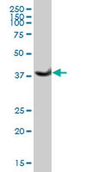 ADH1B purified MaxPab mouse polyclonal antibody (B01P)