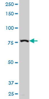 ADD3 polyclonal antibody (A01)