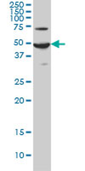 ADCYAP1R1 monoclonal antibody (M01), clone 2B12