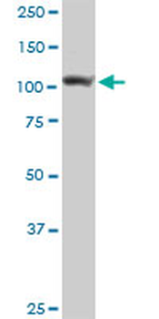 ADAR MaxPab rabbit polyclonal antibody (D01)