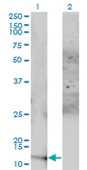 ACYP1 monoclonal antibody (M01), clone S3