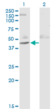 ACY1 monoclonal antibody (M02), clone 1A11-F6