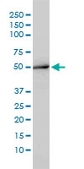ACY1 monoclonal antibody (M01), clone 4F1-B7