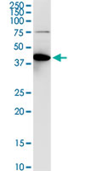 ACY1 purified MaxPab rabbit polyclonal antibody (D01P)