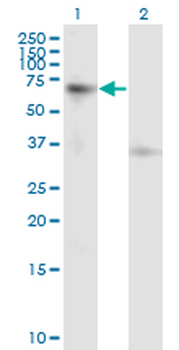 ACVR1B monoclonal antibody (M09), clone 1C1