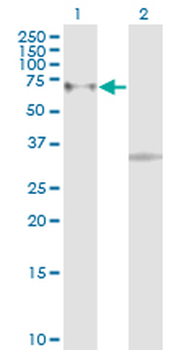 ACVR1B monoclonal antibody (M08), clone 6G11