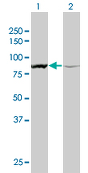 ACTN1 monoclonal antibody (M01A), clone 3F1