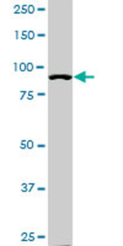 ACTN4 monoclonal antibody (M01A), clone 4D10