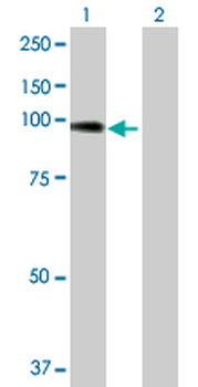 ACTN4 purified MaxPab rabbit polyclonal antibody (D01P)