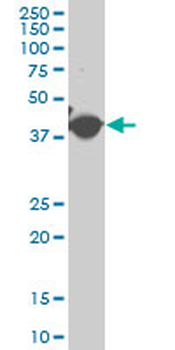 ACTG2 polyclonal antibody (A01)