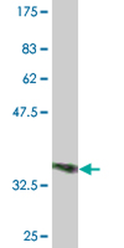 ACP5 monoclonal antibody (M01), clone 2D9