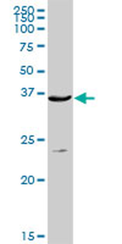 ACP5 purified MaxPab rabbit polyclonal antibody (D01P)