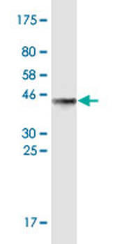 ACP1 monoclonal antibody (M10), clone 2A15