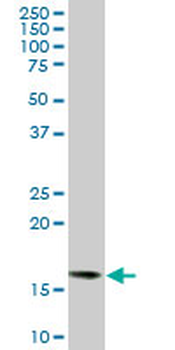ACP1 monoclonal antibody (M06), clone 2A3