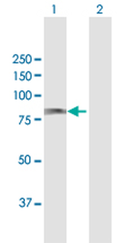 ACOX1 MaxPab rabbit polyclonal antibody (D01)