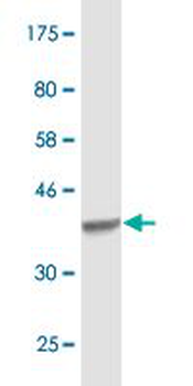 ACO1 monoclonal antibody (M02), clone 2F6