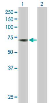 ACHE purified MaxPab rabbit polyclonal antibody (D01P)