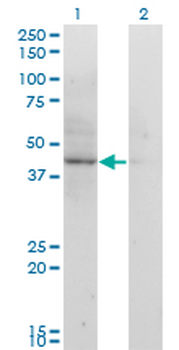 ACAT2 monoclonal antibody (M01), clone 4A5