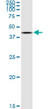 ACAT2 MaxPab rabbit polyclonal antibody (D01)