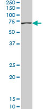 ACADVL monoclonal antibody (M01), clone 5D3