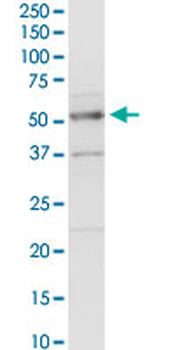 ACADM MaxPab rabbit polyclonal antibody (D01)