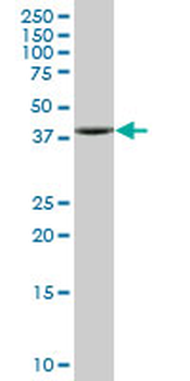 ACADM purified MaxPab mouse polyclonal antibody (B01P)