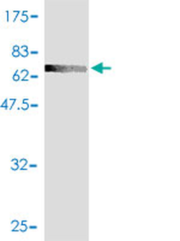 ACADL polyclonal antibody (A01)