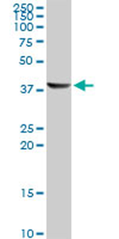 ACAA1 monoclonal antibody (M01), clone 3F11