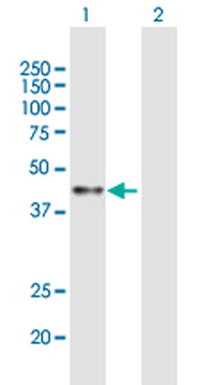 ACAA1 purified MaxPab mouse polyclonal antibody (B01P)