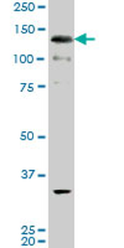 ABL2 monoclonal antibody (M10), clone 3E4