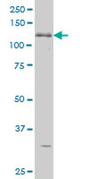 ABL2 monoclonal antibody (M09), clone 5C6