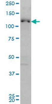 ABL2 monoclonal antibody (M03), clone 6D5