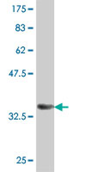 ABCF1 polyclonal antibody (A01)