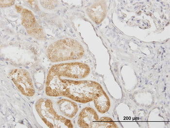 SERPINA3 monoclonal antibody (M02), clone 1C10
