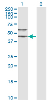 SERPINA3 monoclonal antibody (M01), clone 1E6