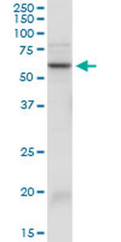 SERPINA3 purified MaxPab rabbit polyclonal antibody (D01P)