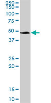 SERPINA3 purified MaxPab mouse polyclonal antibody (B01P)