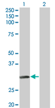 NAT2 monoclonal antibody (M01), clone 3B5