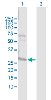 NAT2 MaxPab rabbit polyclonal antibody (D01)