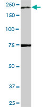 A2M MaxPab rabbit polyclonal antibody (D01)