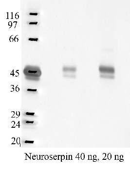 Anti-SERPINI1 Rabbit Polyclonal Antibody