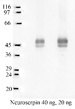 Anti-SERPINI1 Rabbit Polyclonal Antibody