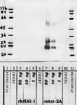 Anti-SPINT2 Rabbit Polyclonal Antibody