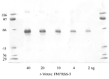 Anti-TMPRSS5 Rabbit Polyclonal Antibody