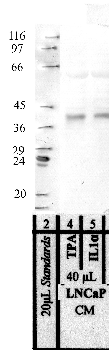 Anti-PRSS8 Rabbit Polyclonal Antibody
